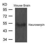 Western blot - Neuroserpin Antibody from Signalway Antibody (21618) - Antibodies.com