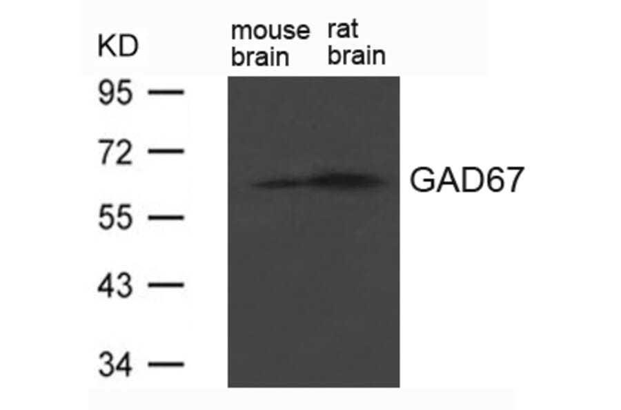 Western blot - GAD67 (GAD1) Antibody from Signalway Antibody (21624) - Antibodies.com