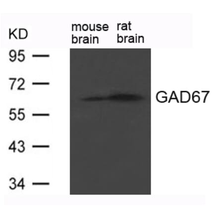 Western blot - GAD67 (GAD1) Antibody from Signalway Antibody (21624) - Antibodies.com