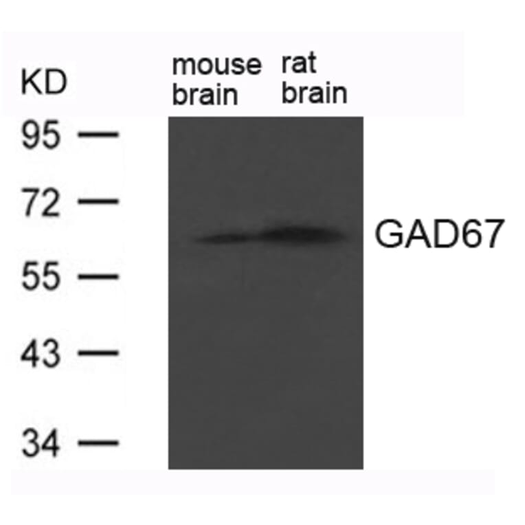 Western blot - GAD67 (GAD1) Antibody from Signalway Antibody (21624) - Antibodies.com