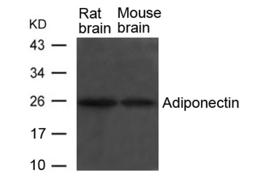 Western blot - Adiponectin Antibody from Signalway Antibody (21665) - Antibodies.com