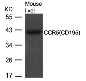 Western blot - CCR5 (CD195) Antibody from Signalway Antibody (21666) - Antibodies.com
