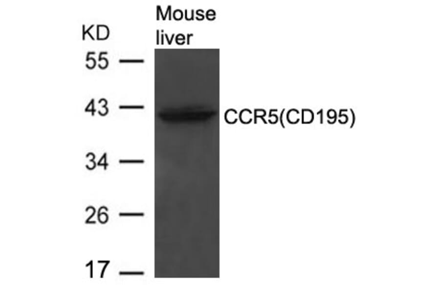 Western blot - CCR5 (CD195) Antibody from Signalway Antibody (21666) - Antibodies.com