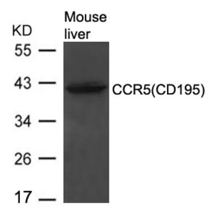 Western blot - CCR5 (CD195) Antibody from Signalway Antibody (21666) - Antibodies.com