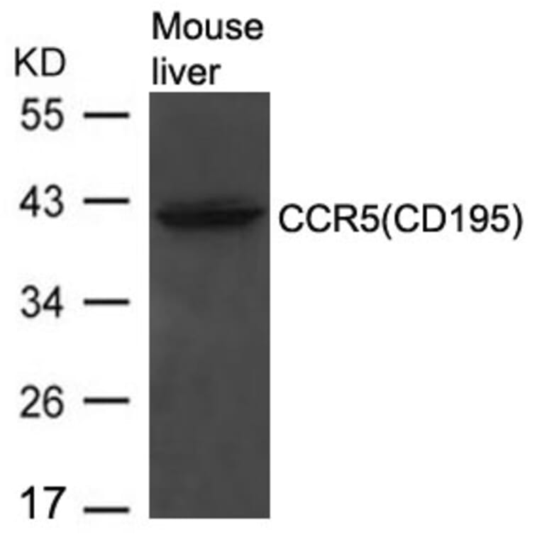 Western blot - CCR5 (CD195) Antibody from Signalway Antibody (21666) - Antibodies.com
