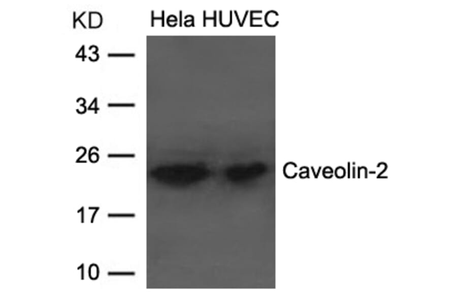 Western blot - Caveolin-2 Antibody  from Signalway Antibody (21687) - Antibodies.com