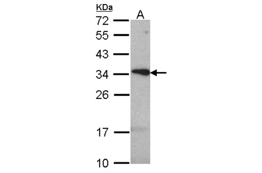 tetraspan 1 antibody from Signalway Antibody (22046) - Antibodies.com