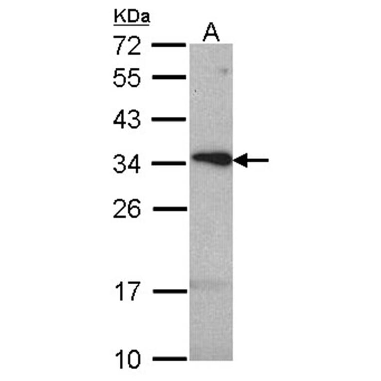 tetraspan 1 antibody from Signalway Antibody (22046) - Antibodies.com