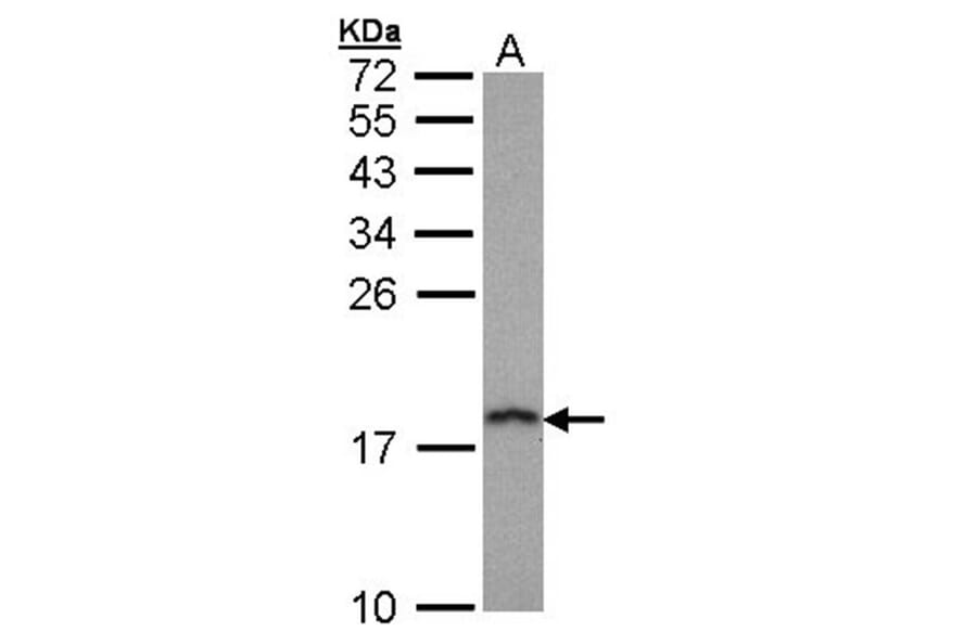 prefoldin 5 antibody from Signalway Antibody (22047) - Antibodies.com