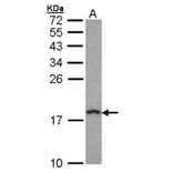 prefoldin 5 antibody from Signalway Antibody (22047) - Antibodies.com