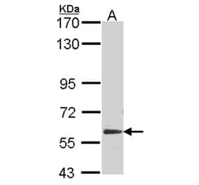 Glypican 5 antibody from Signalway Antibody (22255) - Antibodies.com