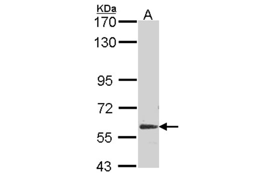Glypican 5 antibody from Signalway Antibody (22255) - Antibodies.com