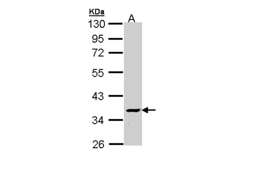 V-ATPase C2 antibody from Signalway Antibody (22332) - Antibodies.com