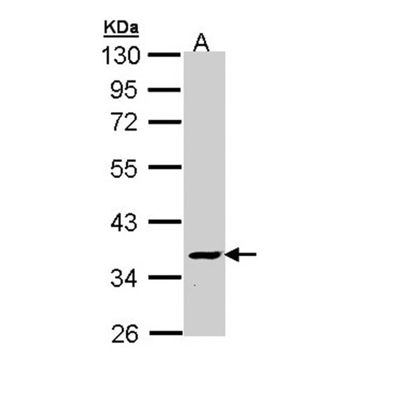 V-ATPase C2 antibody from Signalway Antibody (22332) - Antibodies.com