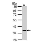 V-ATPase C2 antibody from Signalway Antibody (22332) - Antibodies.com