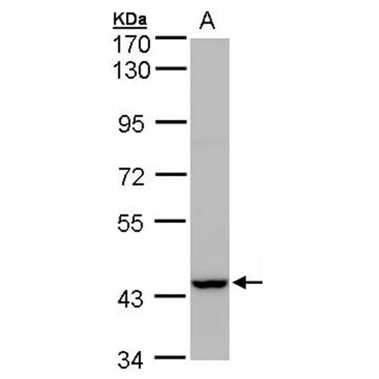 Peroxin 13 antibody from Signalway Antibody (22718) - Antibodies.com