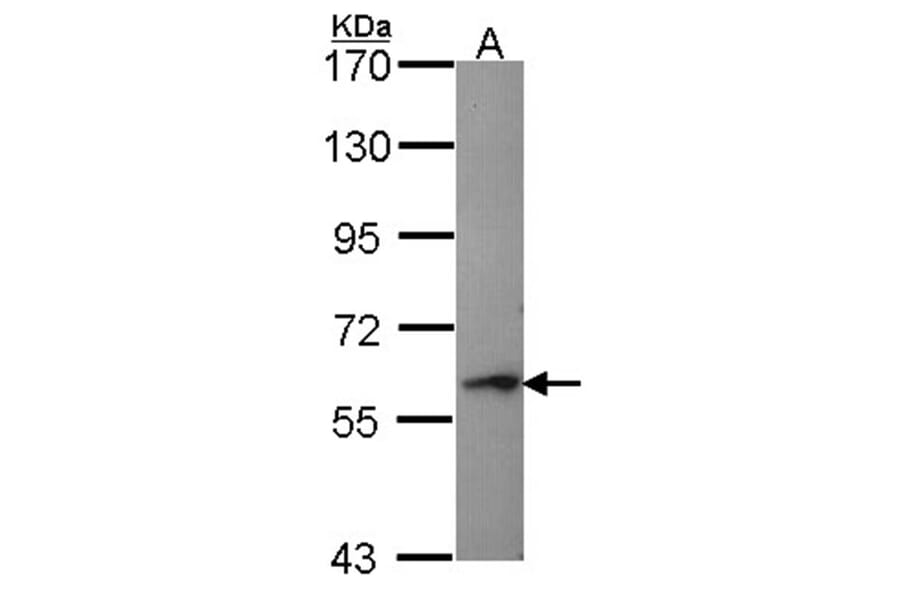 Perforin 1 antibody from Signalway Antibody (22732) - Antibodies.com