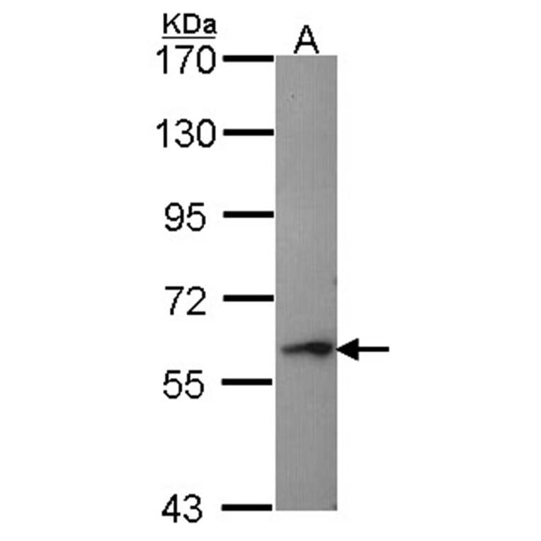Perforin 1 antibody from Signalway Antibody (22732) - Antibodies.com