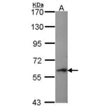 Perforin 1 antibody from Signalway Antibody (22732) - Antibodies.com