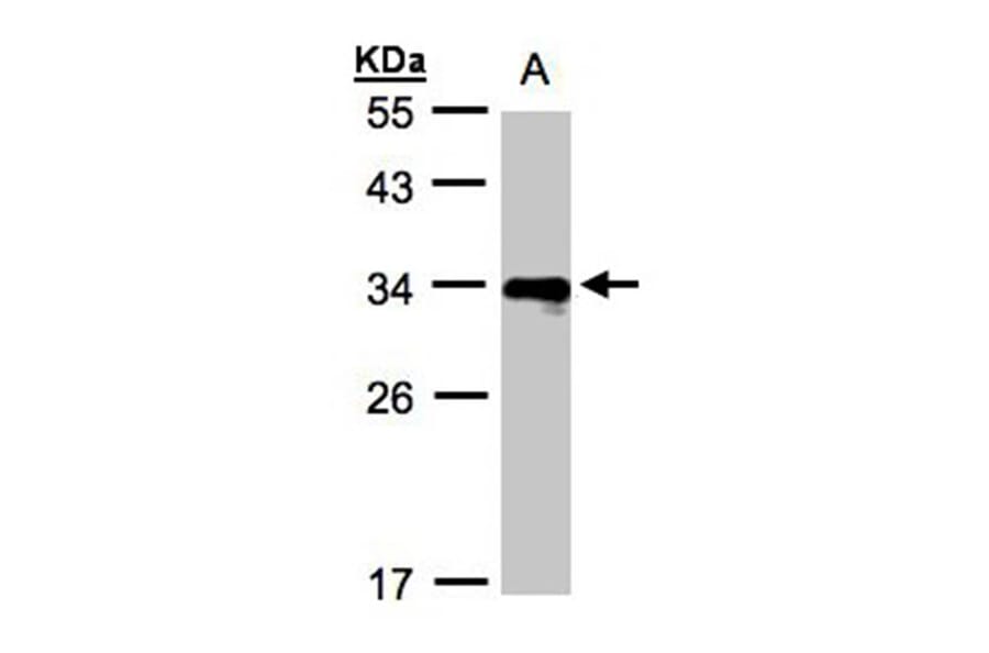 HLA DR beta antibody from Signalway Antibody (23015) - Antibodies.com