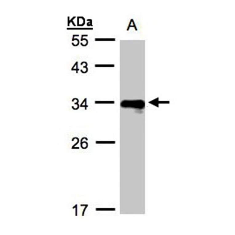 HLA DR beta antibody from Signalway Antibody (23015) - Antibodies.com