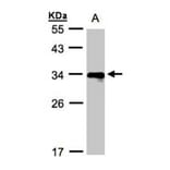 HLA DR beta antibody from Signalway Antibody (23015) - Antibodies.com