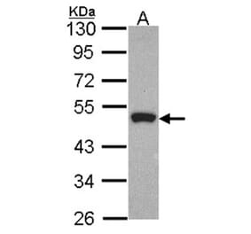 Peripherin antibody from Signalway Antibody (23057) - Antibodies.com