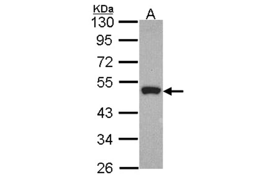 Peripherin antibody from Signalway Antibody (23057) - Antibodies.com