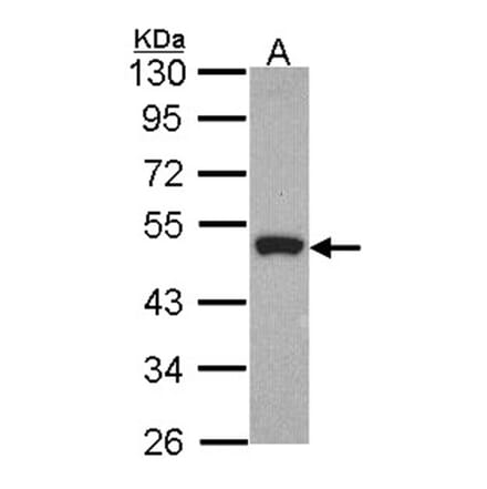 Peripherin antibody from Signalway Antibody (23057) - Antibodies.com