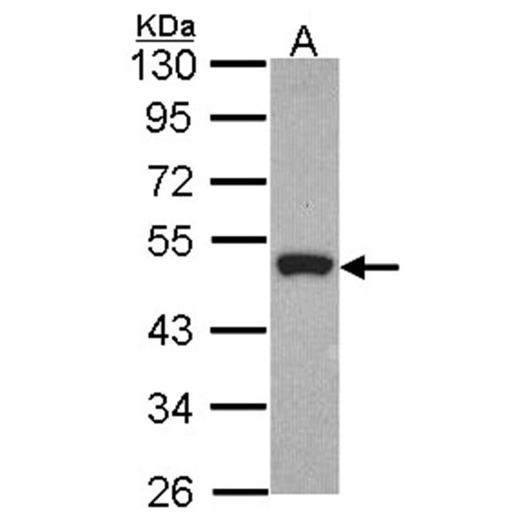 Peripherin antibody from Signalway Antibody (23057) - Antibodies.com