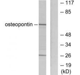 Western blot - Osteopontin Antibody from Signalway Antibody (33455) - Antibodies.com