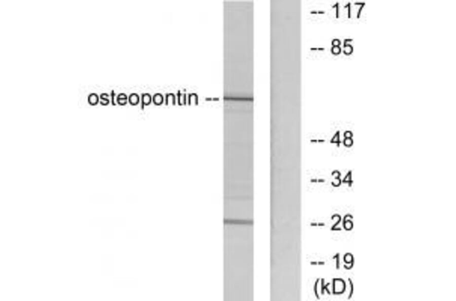 Western blot - Osteopontin Antibody from Signalway Antibody (33455) - Antibodies.com