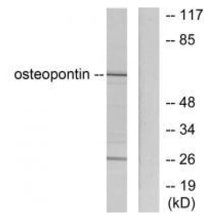 Western blot - Osteopontin Antibody from Signalway Antibody (33455) - Antibodies.com