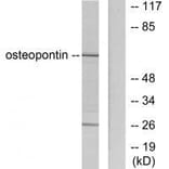Western blot - Osteopontin Antibody from Signalway Antibody (33455) - Antibodies.com