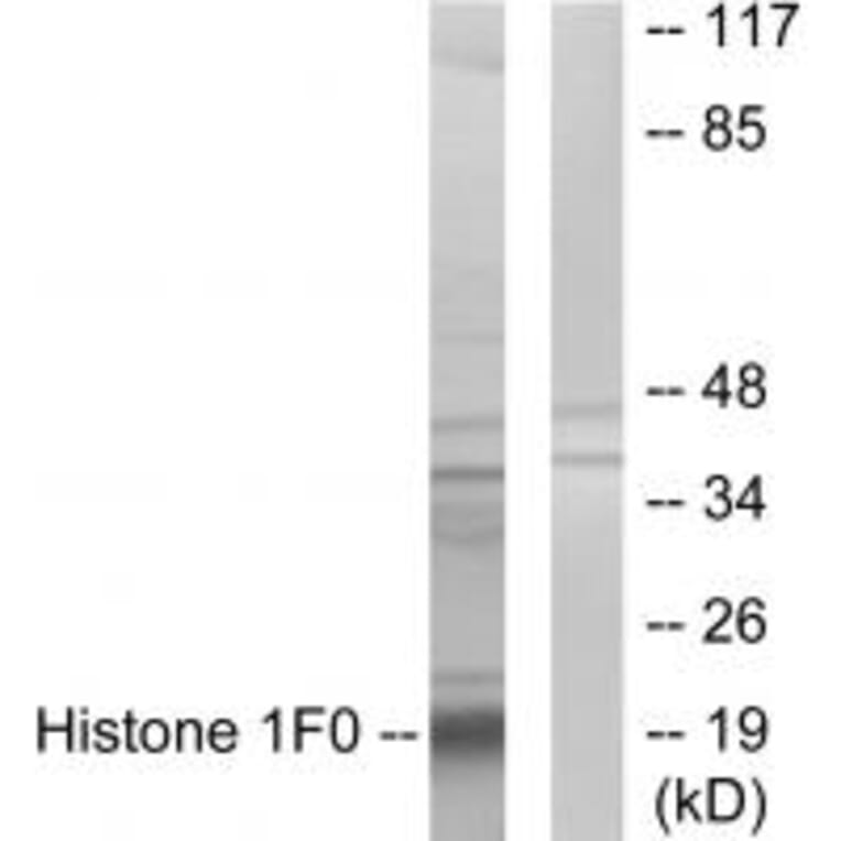 Western blot - Histone 1F0 Antibody from Signalway Antibody (33655) - Antibodies.com