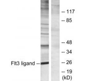 Western blot - Flt3 ligand Antibody from Signalway Antibody (33786) - Antibodies.com