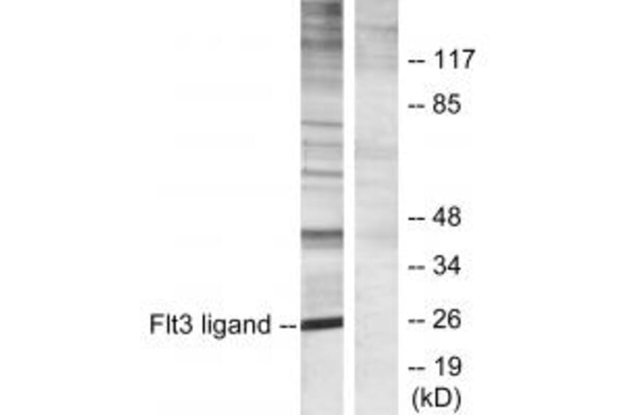 Western blot - Flt3 ligand Antibody from Signalway Antibody (33786) - Antibodies.com