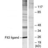 Western blot - Flt3 ligand Antibody from Signalway Antibody (33786) - Antibodies.com