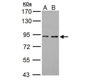 Prothrombin Antibody from Signalway Antibody (35360) - Antibodies.com