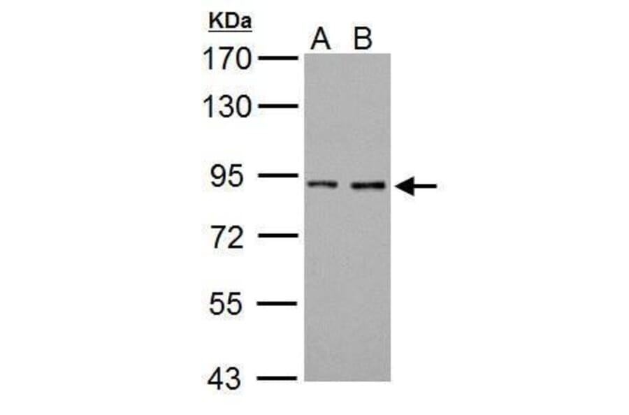 Prothrombin Antibody from Signalway Antibody (35360) - Antibodies.com