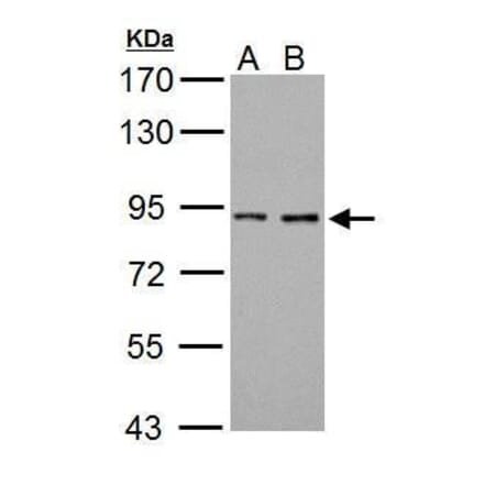 Prothrombin Antibody from Signalway Antibody (35360) - Antibodies.com