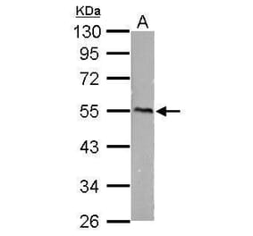 CaMKI gamma Antibody from Signalway Antibody (35430) - Antibodies.com