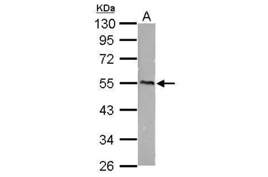 CaMKI gamma Antibody from Signalway Antibody (35430) - Antibodies.com