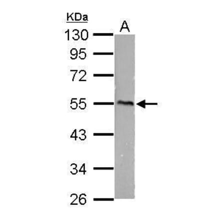 CaMKI gamma Antibody from Signalway Antibody (35430) - Antibodies.com