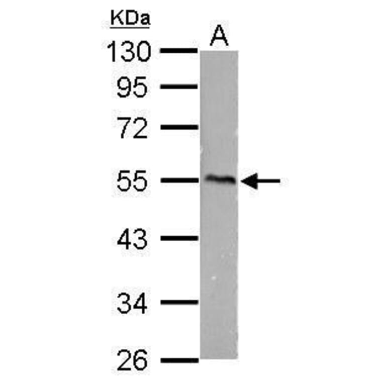 CaMKI gamma Antibody from Signalway Antibody (35430) - Antibodies.com