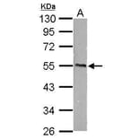 CaMKI gamma Antibody from Signalway Antibody (35430) - Antibodies.com