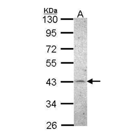CKII alpha Antibody from Signalway Antibody (35452) - Antibodies.com