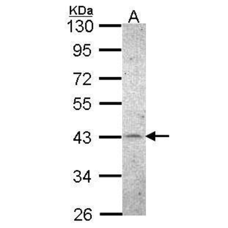 CKII alpha Antibody from Signalway Antibody (35452) - Antibodies.com