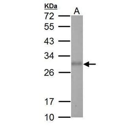 Adiponectin Antibody from Signalway Antibody (35509) - Antibodies.com