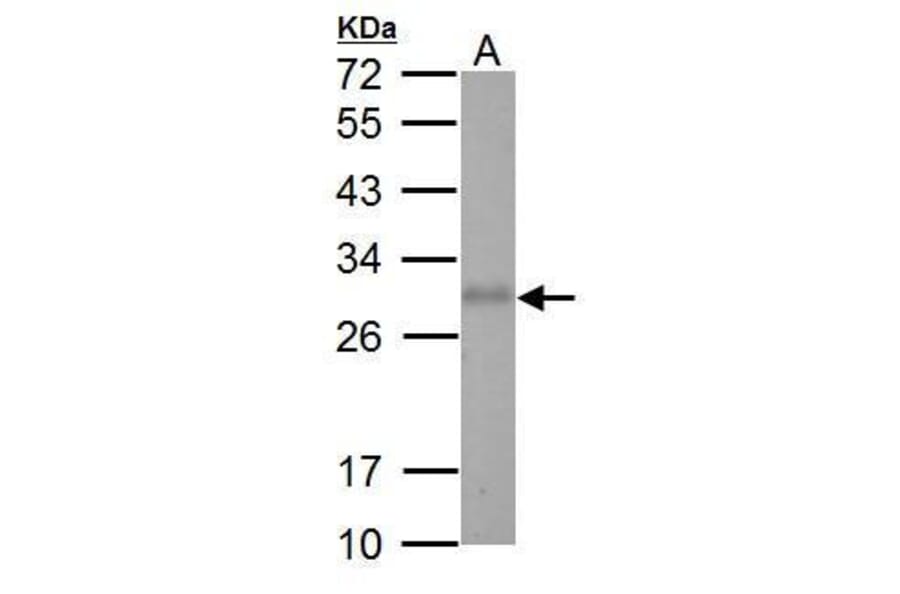 Adiponectin Antibody from Signalway Antibody (35509) - Antibodies.com